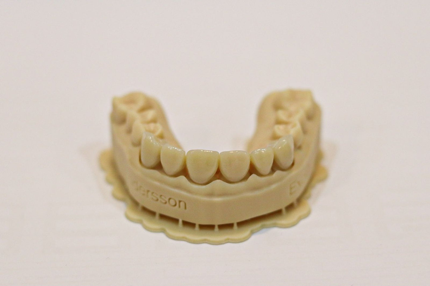 Customized Dental Restoration