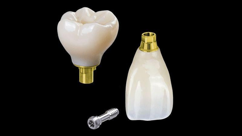 Customized Dental Restoration