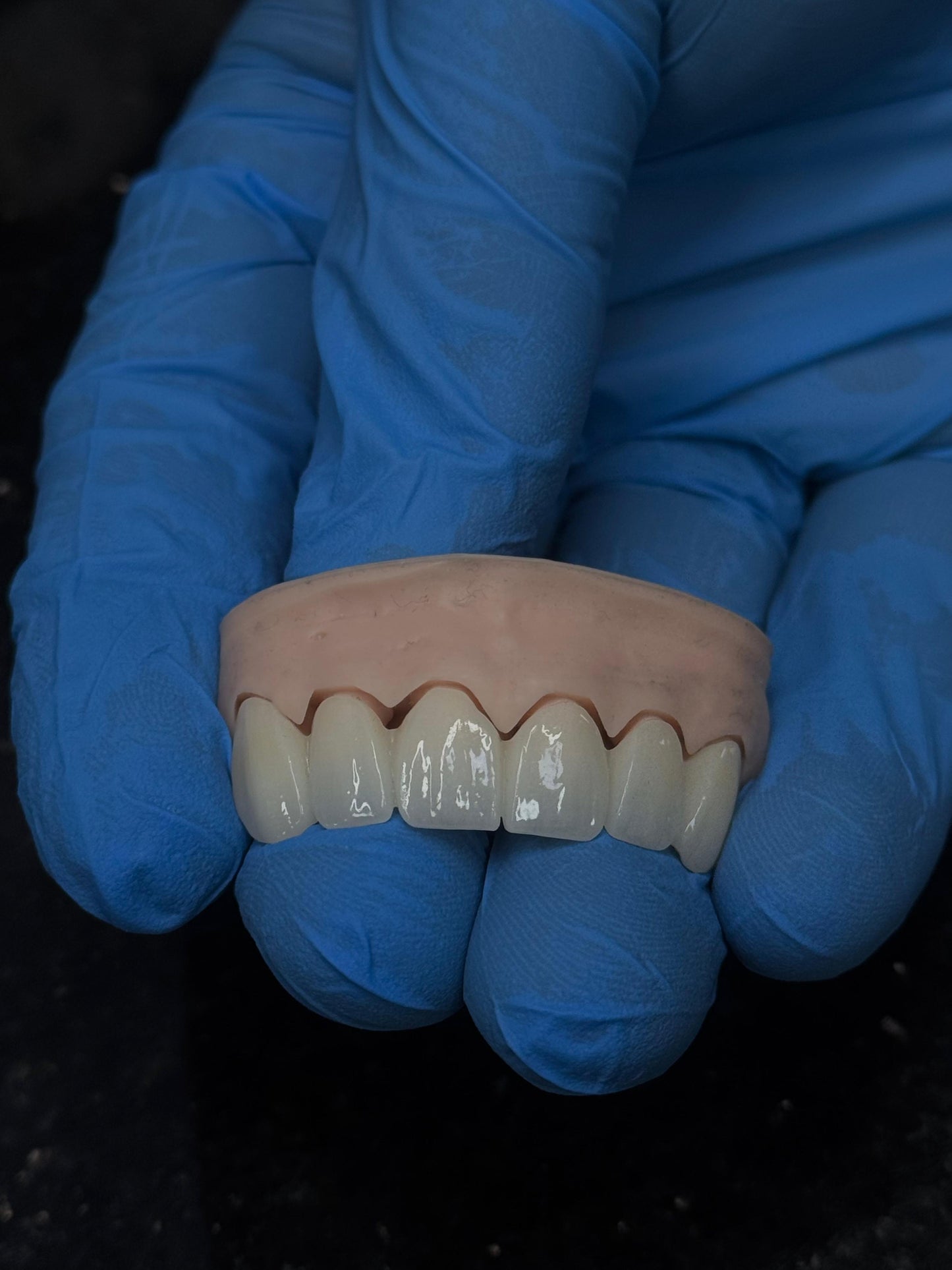 Customized Dental Restoration