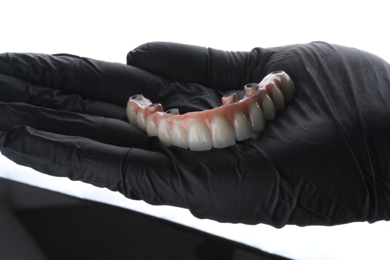 Customized Dental Restoration