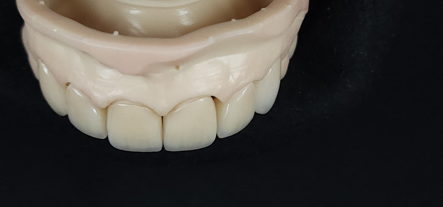 Customized Dental Restoration