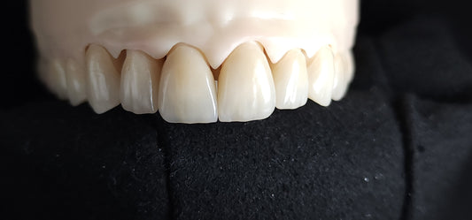 Emax Veneers - Layering Technique