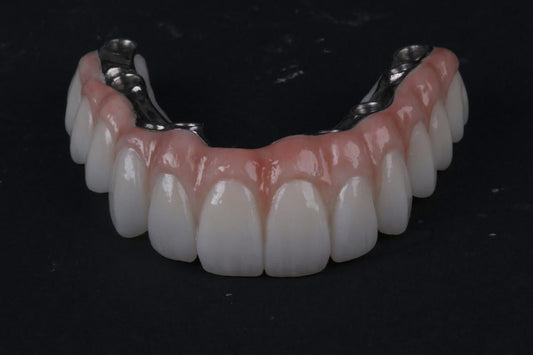 Titanium Bar with Zirconia (12 Teeth)